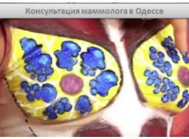 Консультация маммолога
