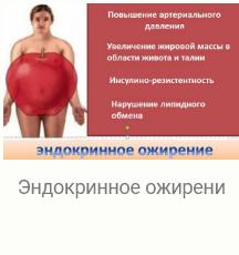 Эндокринное ожирени